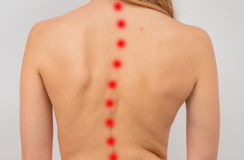 6 Powerful Natural Remedies For Spinal Stenosis