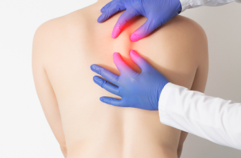 9 Effective Natural Remedies for Ossifying Fibroma